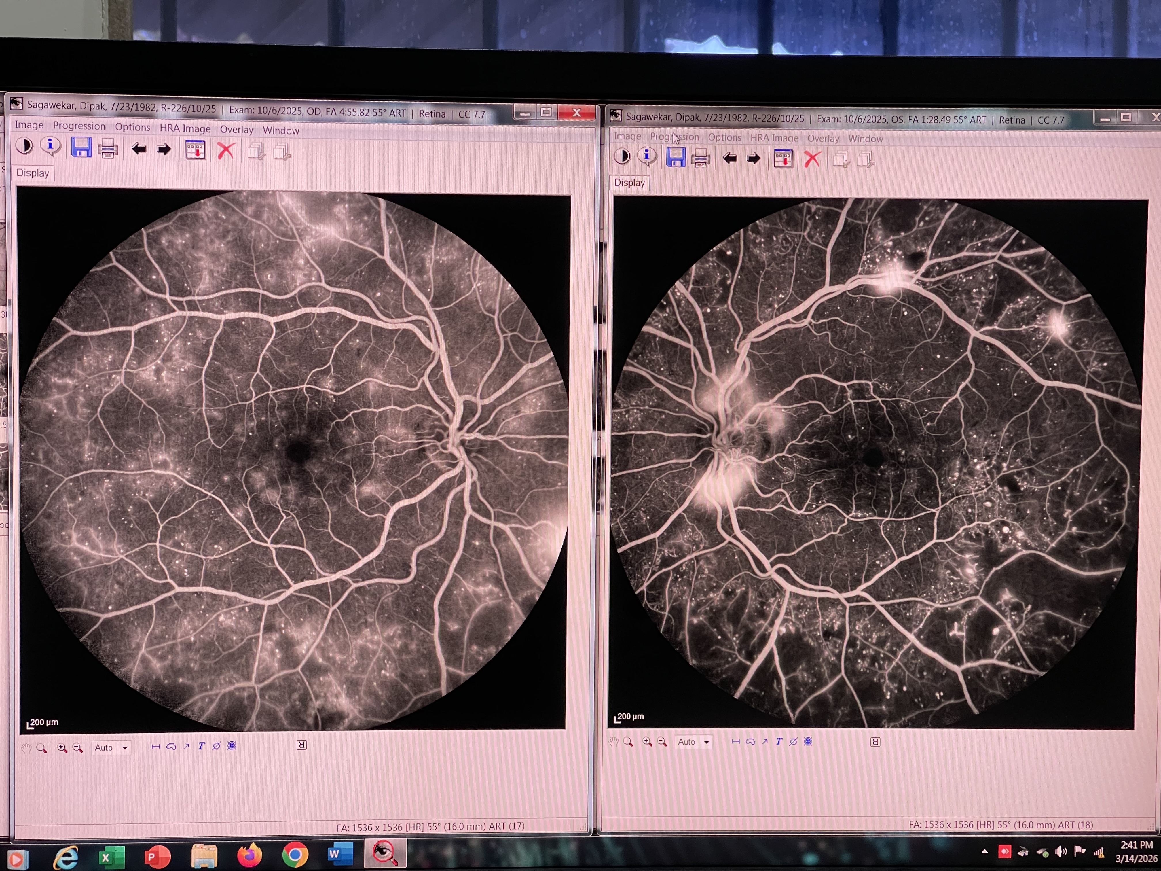 Heranjal’s Advanced Retina Care Center, Vapi — clinic photo 7