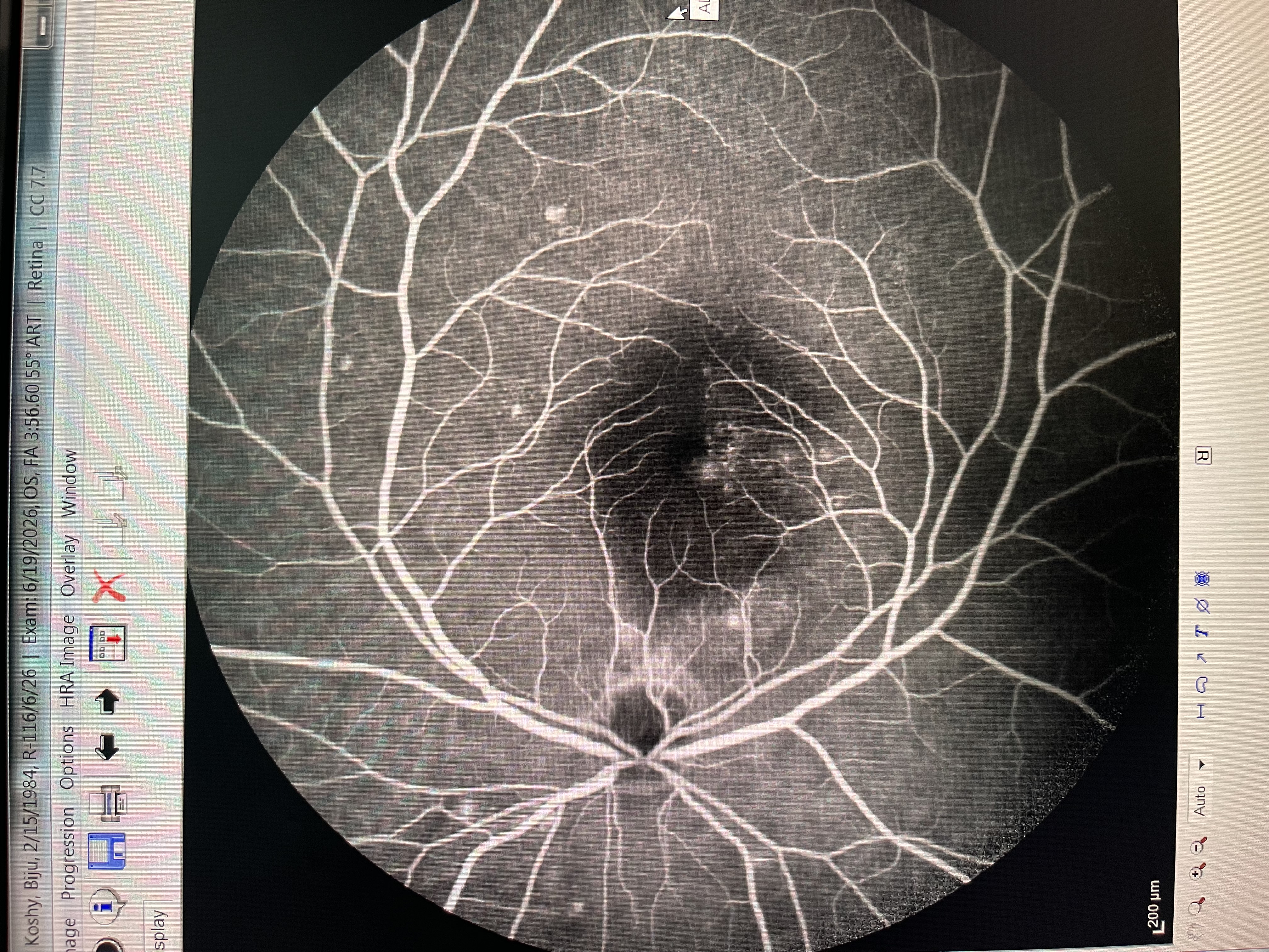 Heranjal’s Advanced Retina Care Center, Vapi — clinic photo 5